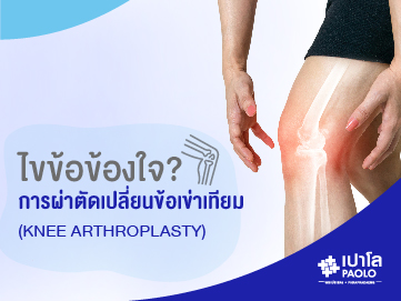 ไขข้อข้องใจ การผ่าตัดเปลี่ยนข้อเข่าเทียม (Knee Arthroplasty)